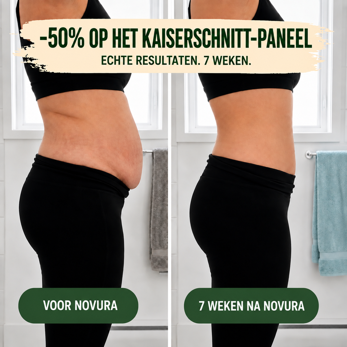 Postpartum corrigerende slip – 360°-compressie