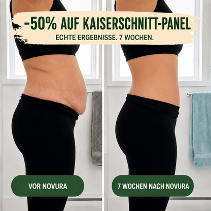 Postpartum-shapewear-slip – 360°-compressie